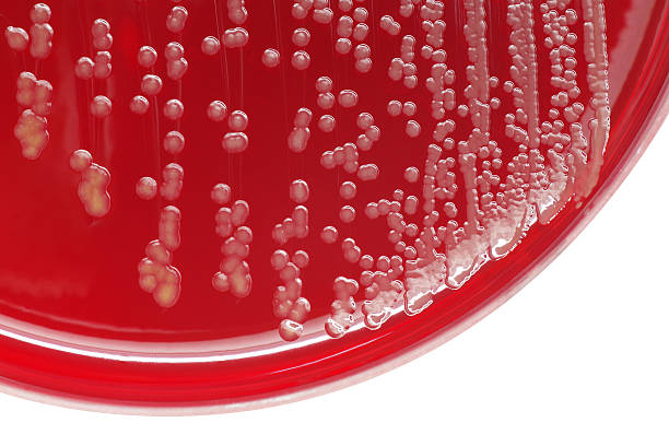 staphylococcus aureus 세균 집락이 혈액 한천 플레이트 - staphylococcus aureus 뉴스 사진 이미지