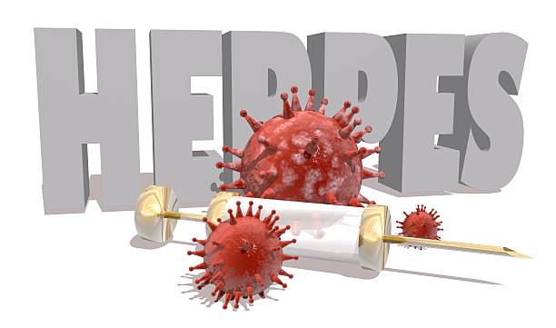 istock Herpes desease, abstract virus models and syringe 515643756