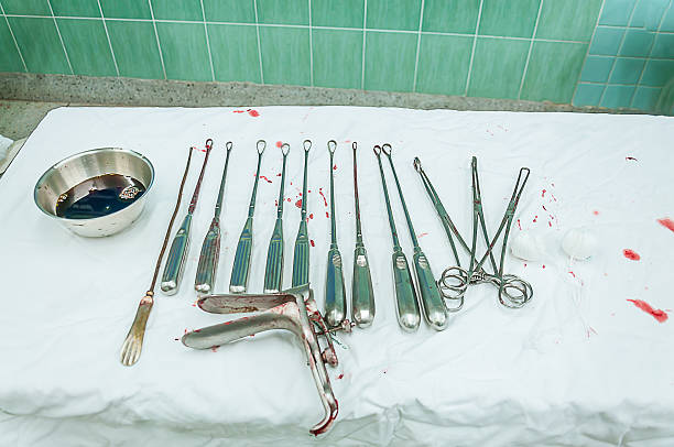 ginecológicas el uso de equipos de tratamiento ginecológicas enfermedad - espéculo fotografías e imágenes de stock