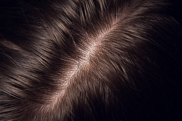 hair and head skin close up