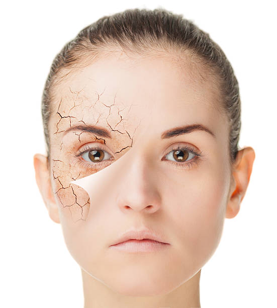 istock Skin care treatment before and after, beauty concept 515805380