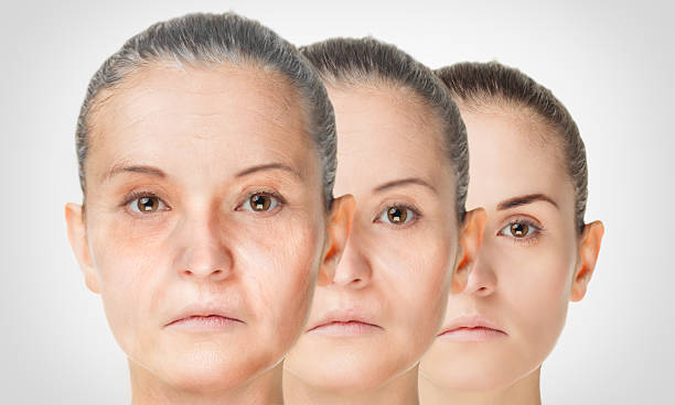 istock Aging process, rejuvenation anti-aging skin procedures 515806010