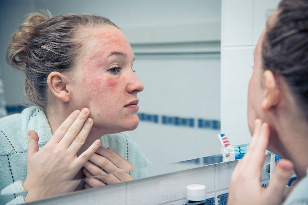 Oh my god, what is that? Woman with allergic reaction looking herself in the mirror. skin stock pictures, royalty-free photos & images