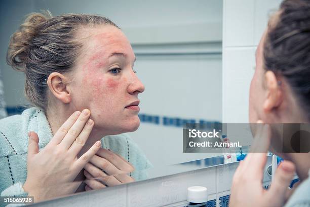 Oh My God What Is That Stock Photo - Download Image Now - Eczema, Human Skin, Allergy