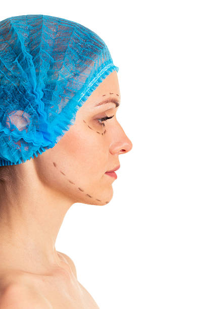 istock Preparation for facial surgery 516069242