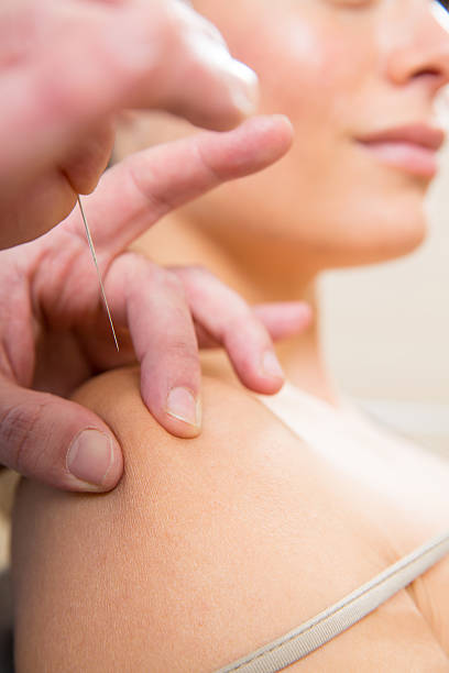 istock Doctor hands acupuncture needle pricking on woman 516160899