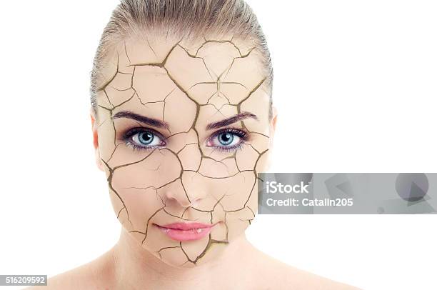 Closeup Of Woman Cracked And Damaged Face Stock Photo - Download Image Now - Cracked, Dry, Human Face