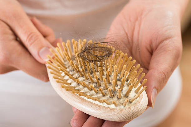 istock Person Hand Holding Comb With Loss Hair 516258884