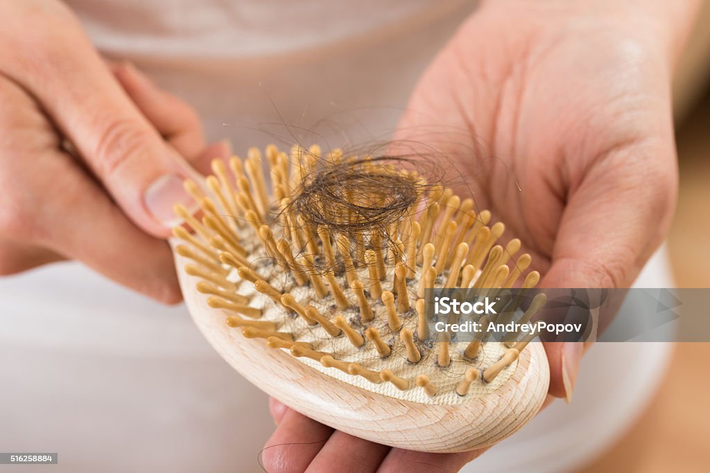 Person Hand Holding Comb With Loss Hair Close-up Of Person Hand Holding Comb With Loss Hair Hair Loss Stock Photo