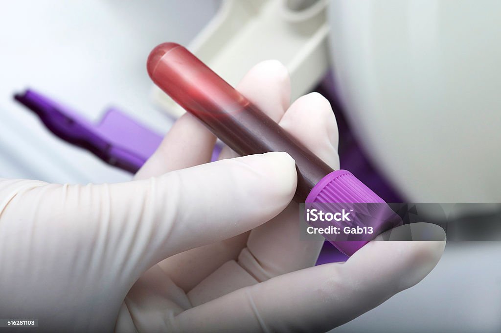 Blood sample Close-up of hand with glove, holding a blood sample in a tube Blood Test Stock Photo