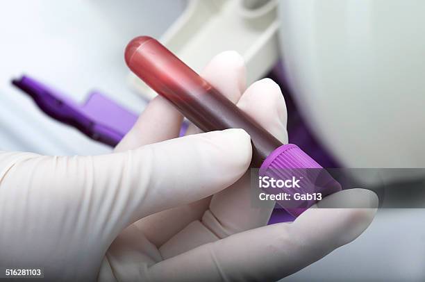 Blood Sample Stock Photo - Download Image Now - Blood Test, Tube, Blood