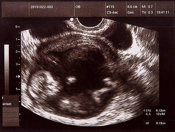 초음파 이미지 가능성을 낮추거나 자궁 내 태아 발육에 - animal uterus 뉴스 사진 이미지