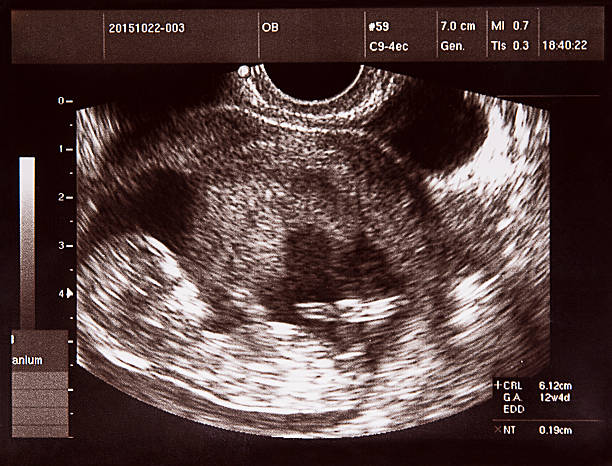 ecografia immagine del bebè in womb - animal uterus foto e immagini stock