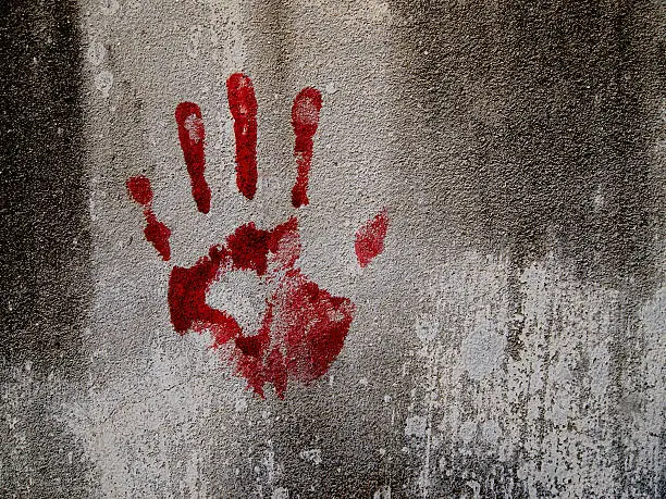 Photo of Bloody hand