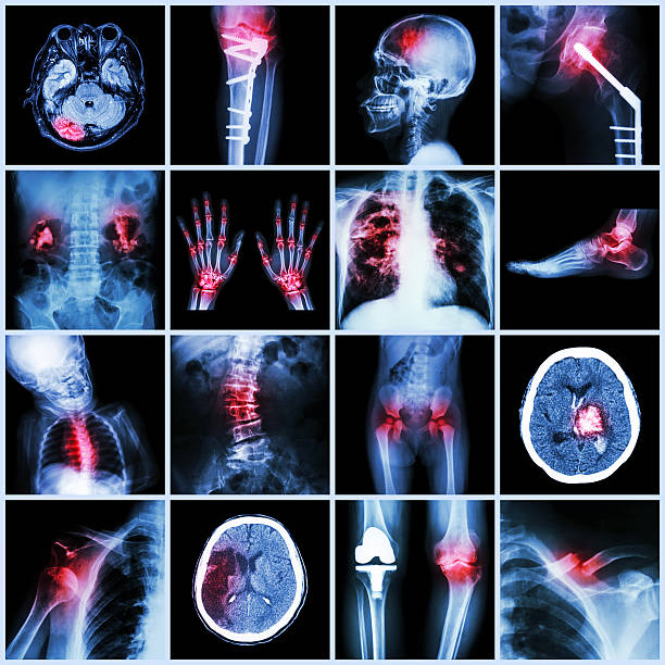 istock Set of X-ray multiple part of human,Multiple disease,orthopedic 516653693