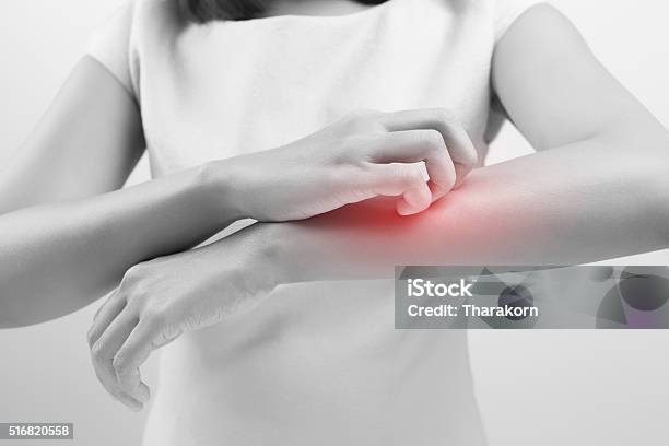 Itching Stock Photo - Download Image Now - Dermatitis, Eczema, Scratching