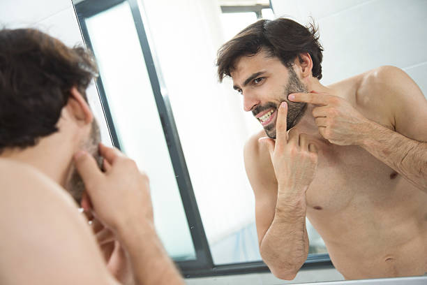 istock Reflection in a mirror of young man squeezing acne. 516928214
