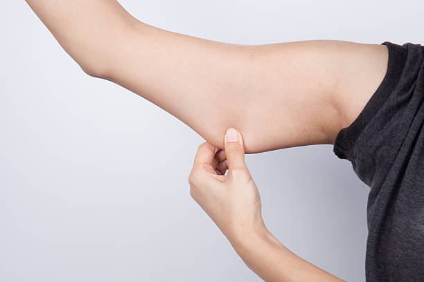 istock Young woman checking her arm fat 517008794