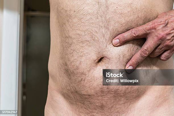 Man Pointing To Umbilical Hernia Belly Button Scar Stock Photo - Download Image Now - Belly Button, Mature Adult, Naked