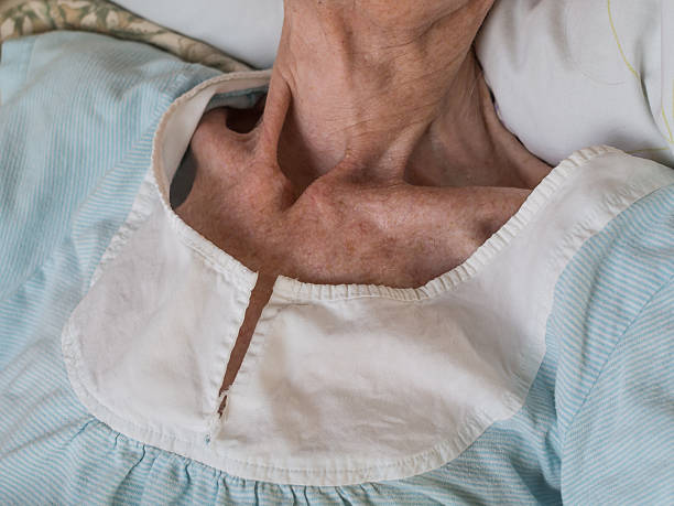 Very skinny old woman lying in a bed stock photo