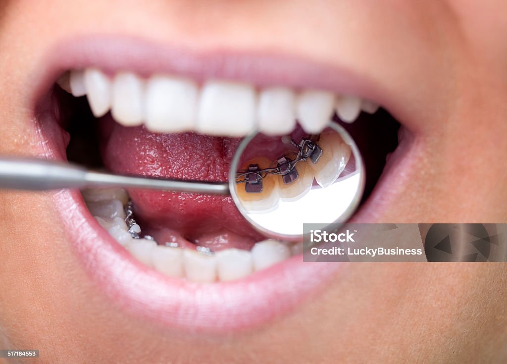 Dental Spiegel mit mehrsprachigen Zahnspange - Lizenzfrei Zahnspange Stock-Foto