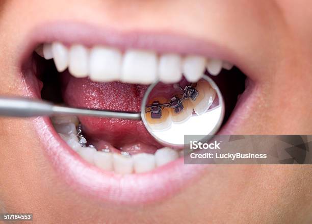 Dental Spiegel Mit Mehrsprachigen Zahnspange Stockfoto und mehr Bilder von Zahnspange - Zahnspange, Reparieren, Zahnarzt