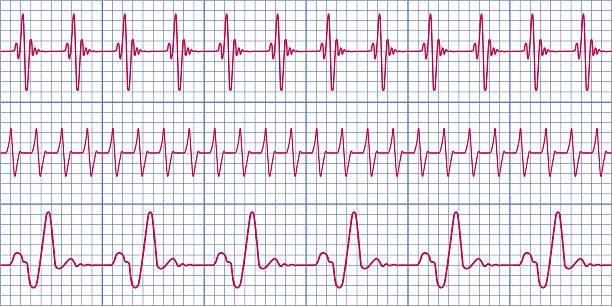 Cardiogram Seamless pattern of the ekg cardiograms chart heartbeat line stock illustrations