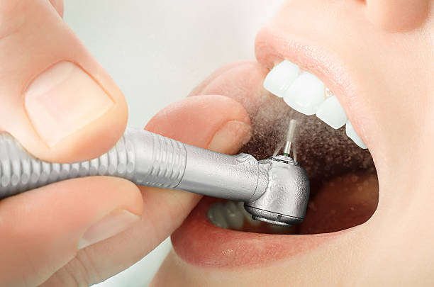 primo piano di un dentista mano foratura denti e spruzzare - human teeth foto e immagini stock