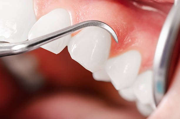 Comprehensive dental examination. Dentist doing examp with hook and mirror - selective focus - close up