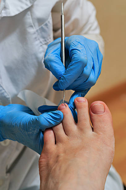 fußpflege - podiatry chiropody toenail human foot stock-fotos und bilder