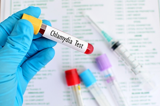 Blood sample for Chlamydia trachomatis (bacteria) test
