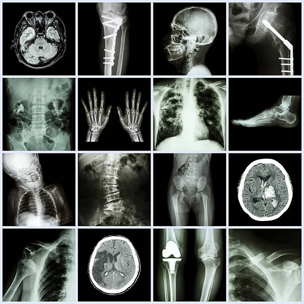 の x 線を複数の部品、複数の疾患を伴う - cat scan pelvis hip human spine ストックフォトと画像