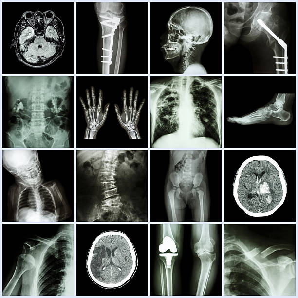 istock Set of X-ray multiple part of human,Multiple disease 517711703