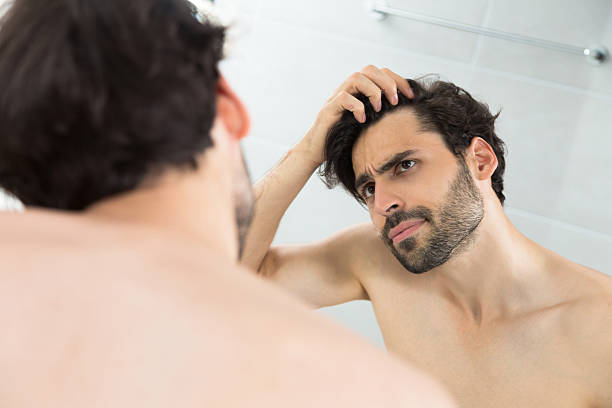 Man having hair loss problem stock photo