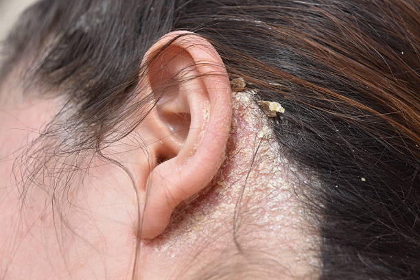 istock woman with serious problem of dandruff 517989052