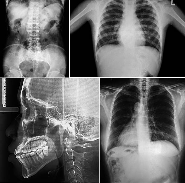 istock Collage of human X-rays photo 518016993