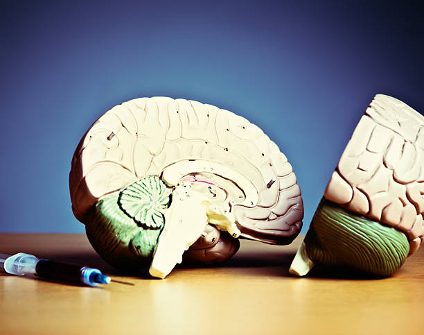 istock Brain damage or vital healthcare? Hypodermic with anatomical model 518095539