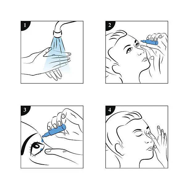 Vector illustration of Eye drops - instillation manual