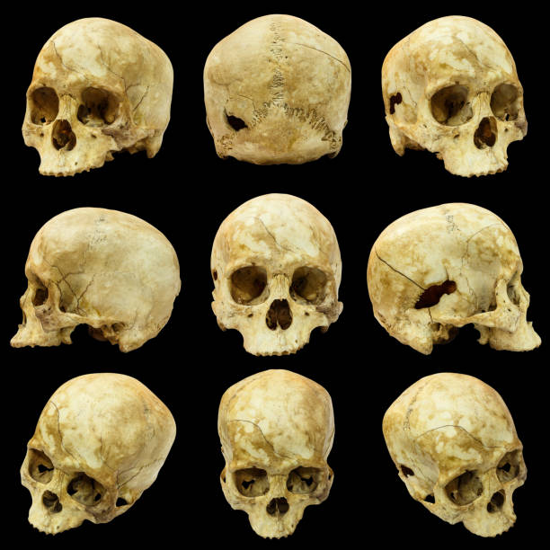 istock Collection of human skull and broken skull 518172481