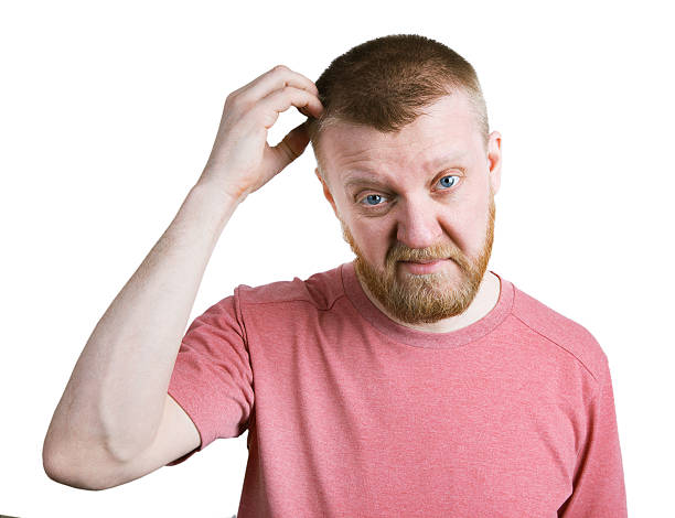 istock Bearded man scratches his head hair 518197400