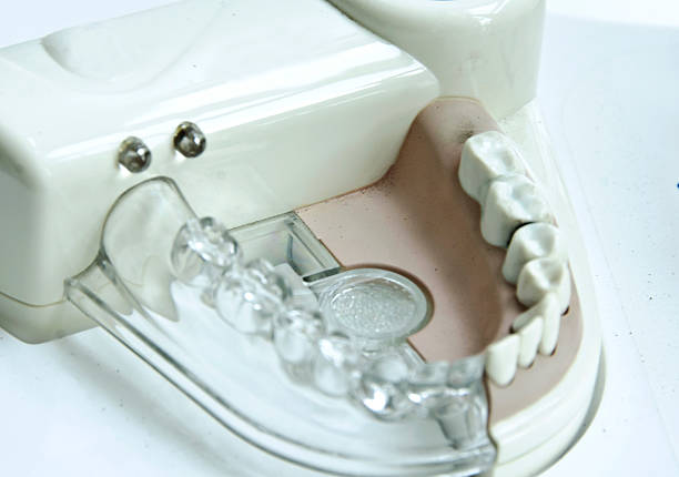 Retainer Inlay Titanium 100+ Inlay Retainer Stock Photos, Pictures & Royalty-Free Images - iStock