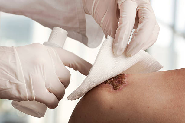Wound dressing Medical assistant changes the dressing of a wound at the emergency room Stuffing stock pictures, royalty-free photos & images