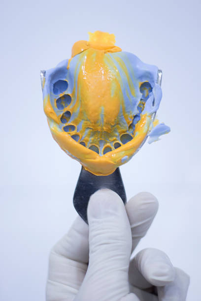 istock Dentist's dental tooth mold 518231668