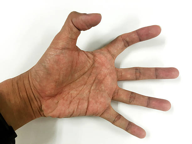 istock Open the palm of the hands 518248988