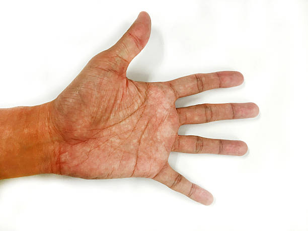 istock Open the palm of the hands 518249104