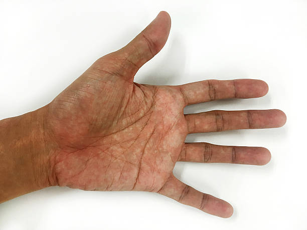 istock Open the palm of the hands 518249134