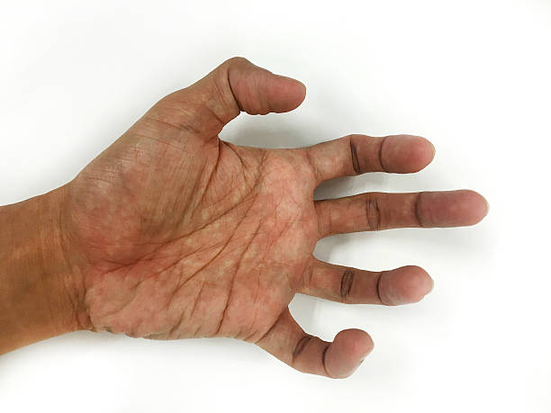 istock Open the palm of the hands 518249176