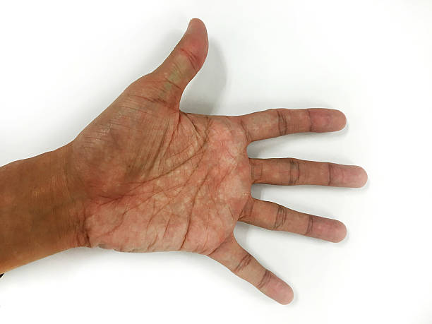 istock Open the palm of the hands 518249210