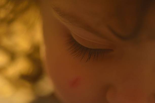 istock Backlit child with a cut on her cheek 518280252