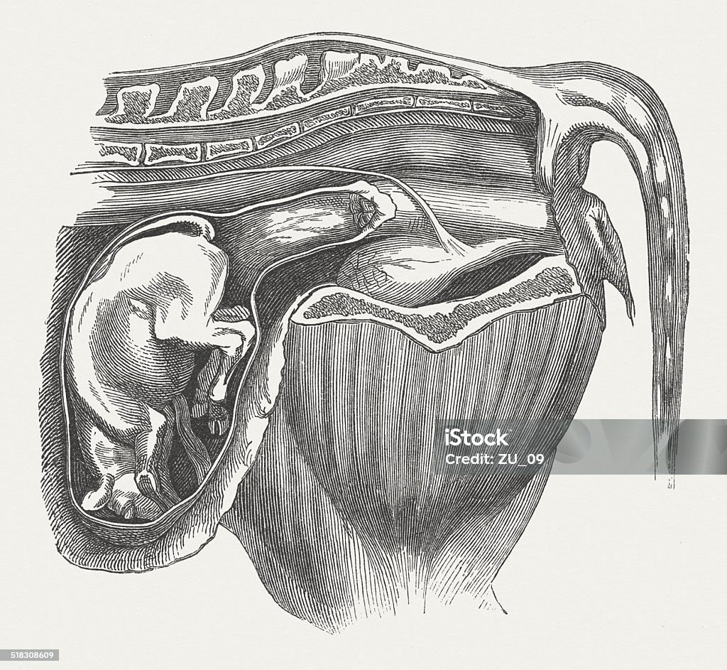 Cow Fetus Abnormal Breech Presentation Hind Legs In Ankle Inflected Stock  Illustration - Download Image Now - iStock